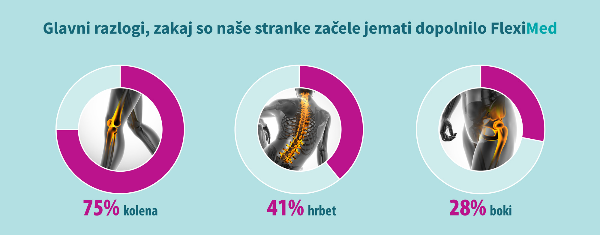 Glavni razlogi, zakaj so naše stranke začele jemati dopolnilo FlexiMed®
